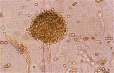 真菌毒素 真菌毒素